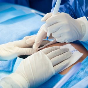 Electrosurgery, electrosurgical equipment